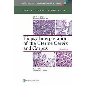 Biopsy Interpretation of the Uterine Cervix and Corpus, Hardback - *** imagine