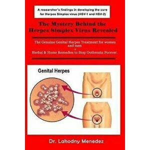 The Mystery Behind the Herpes Simplex Virus Revealed: The Genuine Genital Herpes Treatment for women and men + Herbal & Home Remedies to Stop Outbreak imagine