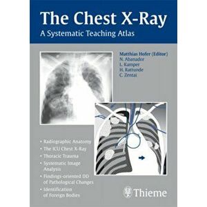 The Chest X-Ray. A Systematic Teaching Atlas, Paperback - Matthias Hofer imagine