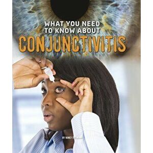 What You Need to Know about Conjunctivitis, Hardback - Nancy Dickmann imagine
