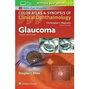 Glaucoma, Paperback - Douglas Rhee imagine