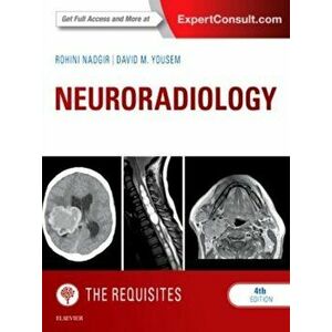 Neuroradiology: The Requisites, Hardback - David M. Yousem imagine