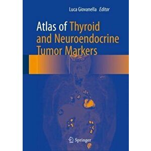 Atlas of Thyroid and Neuroendocrine Tumor Markers, Hardback - *** imagine