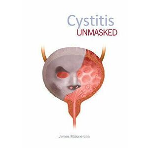Cystitis Unmasked, Paperback - James Malone-Lee imagine