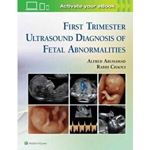 First Trimester Ultrasound Diagnosis of Fetal Abnormalities, Hardback - Rabih Chaoui imagine