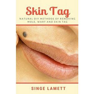 Skin Tag: Natural DIY Methods of removing Mole, Wart and Skin Tag, Paperback - Singe Lamett imagine