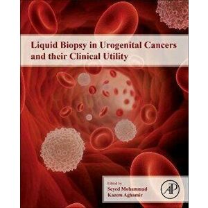 Liquid Biopsy in Urogenital Cancers and its Clinical Utility, Paperback - *** imagine