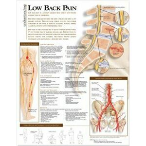 Understanding Low Back Pain Anatomical Chart - *** imagine