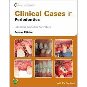 Clinical Cases in Periodontics 2e, Paperback - N Karimbux imagine