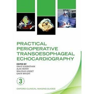 Practical Perioperative Transoesophageal Echocardiography, Paperback - David Sidebotham imagine
