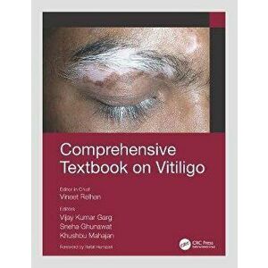 Comprehensive Textbook on Vitiligo, Paperback - *** imagine