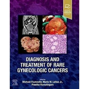 Diagnosis and Treatment of Rare Gynecologic Cancers, Hardback - *** imagine