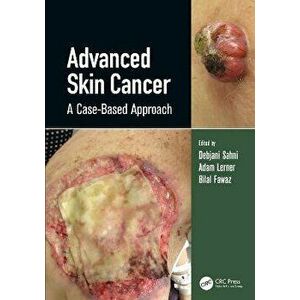 Advanced Skin Cancer. A Case-Based Approach, Hardback - *** imagine