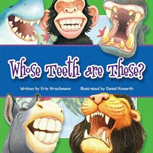 Whose Teeth Are These?, Board book - *** imagine