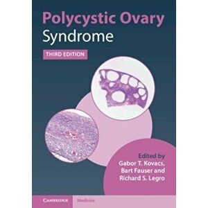 Polycystic Ovary Syndrome. 3 Revised edition, Hardback - *** imagine