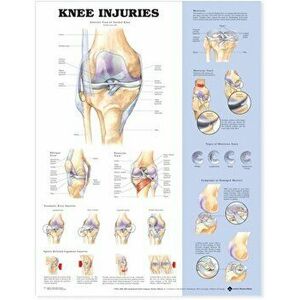 Knee Injuries Anatomical Chart - *** imagine