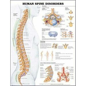 Human Spine Disorders Anatomical Chart. 2 ed - *** imagine