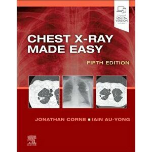 Chest X-Ray Made Easy. 5 ed, Paperback - *** imagine