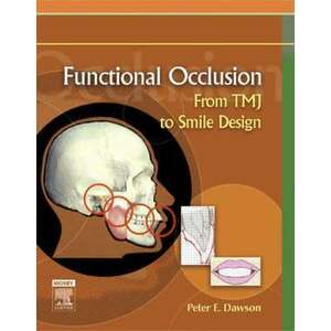 Functional Occlusion imagine