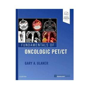 Fundamentals of Oncologic PET/CT - Gary Ulaner imagine