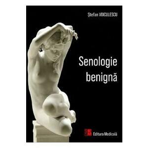 Senologie benigna - Stefan Voiculescu imagine