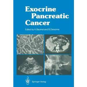 Exocrine Pancreatic Cancer imagine