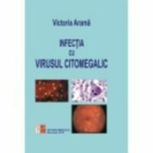 Infectia cu virusul citomegalic - Victoria Arama imagine