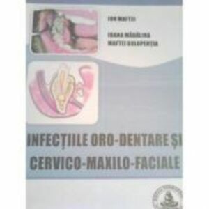 Infectiile oro-dentare si cervico-maxilo-faciale - Ion Maftei imagine