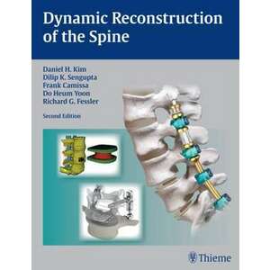 Dynamic Reconstruction of the Spine imagine