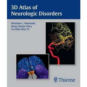 3D Atlas of Neurologic Disorders imagine
