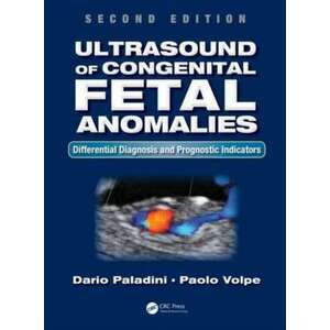 Ultrasound of Congenital Fetal Anomalies imagine
