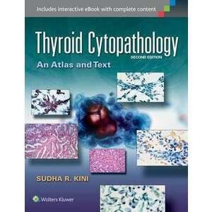 Thyroid Cytopathology imagine