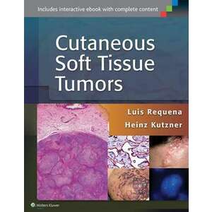 Cutaneous Soft Tissue Tumors imagine