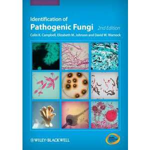 Identification of Pathogenic Fungi imagine