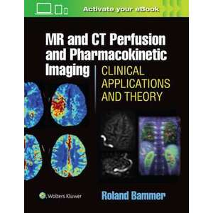 MR and CT Perfusion and Pharmacokinetic Imaging: Clinical Applications and Theoretical Principles imagine