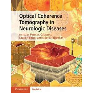 Optical Coherence Tomography in Neurologic Diseases imagine