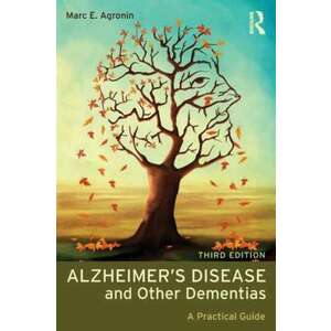 Alzheimer's Disease and Other Dementias imagine