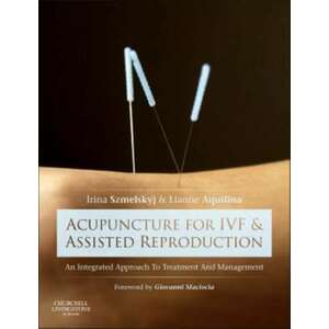 Acupuncture for IVF and Assisted Reproduction imagine