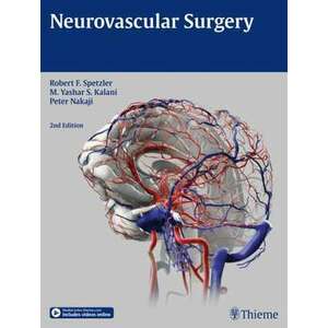 Neurovascular Surgery imagine