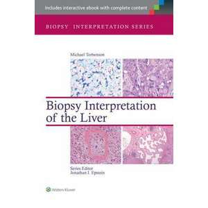 Biopsy Interpretation of the Liver imagine