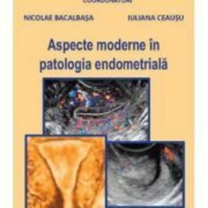 Aspecte moderne in patologia endometriala - Nicolae Bacalbasa, Iuliana Ceausu imagine