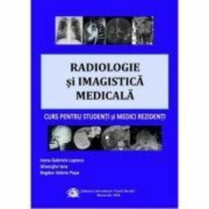 Radiologie si imagistica medicala, curs pentru studenti si medici rezidenti - Ioana Gabriela Lupescu imagine