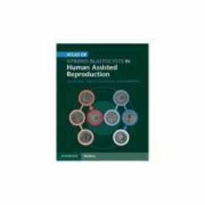 Atlas of Vitrified Blastocysts in Human Assisted Reproduction - Thomas Ebner, Pierre Vanderzwalmen, Barbara Wirleitner imagine