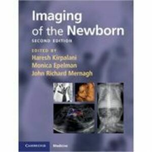 Imaging of the Newborn - Haresh Kirpalani, Monica Epelman, John Richard Mernagh imagine