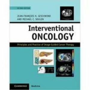Interventional Oncology: Principles and Practice of Image-Guided Cancer Therapy - Jean-Francois H. Geschwind, Michael C. Soulen imagine