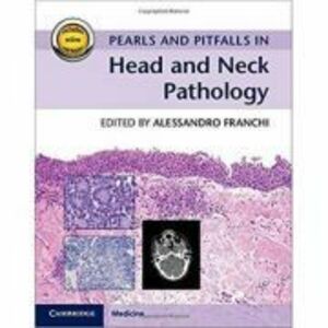 Pearls and Pitfalls in Head and Neck Pathology - Alessandro Franchi imagine
