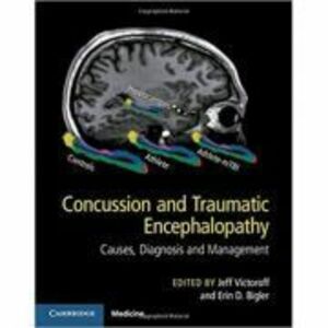 Concussion and Traumatic Encephalopathy: Causes, Diagnosis and Management - Jeff Victoroff, Erin D. Bigler imagine
