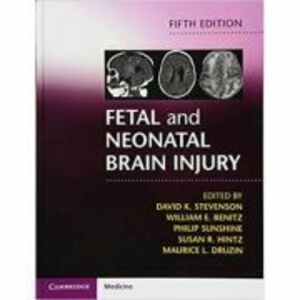 Fetal and Neonatal Brain Injury - David K. Stevenson, William E. Benitz, Philip Sunshine, Susan R. Hintz, Maurice L. Druzin imagine