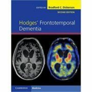 Hodges' Frontotemporal Dementia - Bradford C. Dickerson imagine