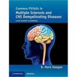Common Pitfalls in Multiple Sclerosis and CNS Demyelinating Diseases: Case-Based Learning - B. Mark Keegan imagine